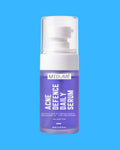 Anti Acne Face Serum with 10% Azelaic Acid & 2% Salicylic Acid - 30 Ml
